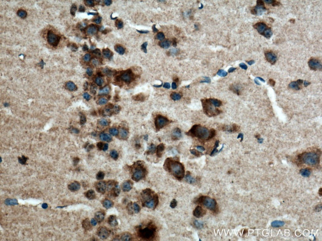 CACNG7 Antibody in Immunohistochemistry (Paraffin) (IHC (P))