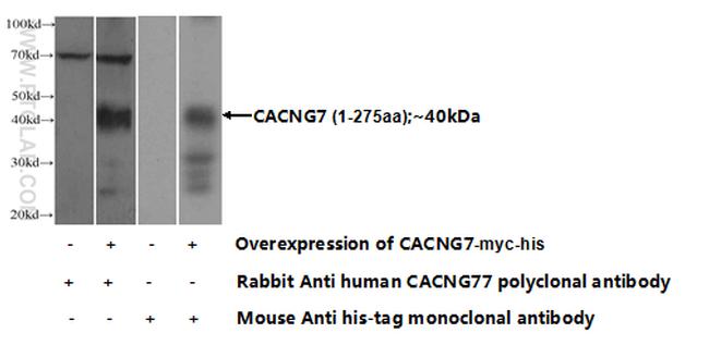 CACNG7 Antibody in Western Blot (WB)