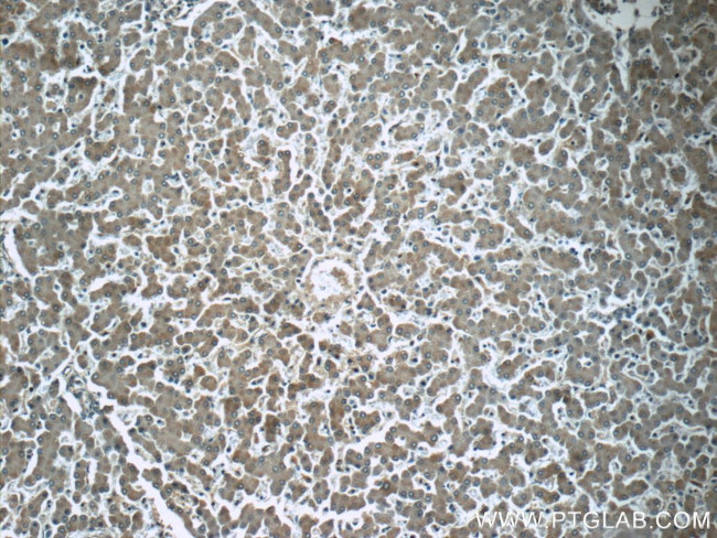 CYP2D6 Antibody in Immunohistochemistry (Paraffin) (IHC (P))