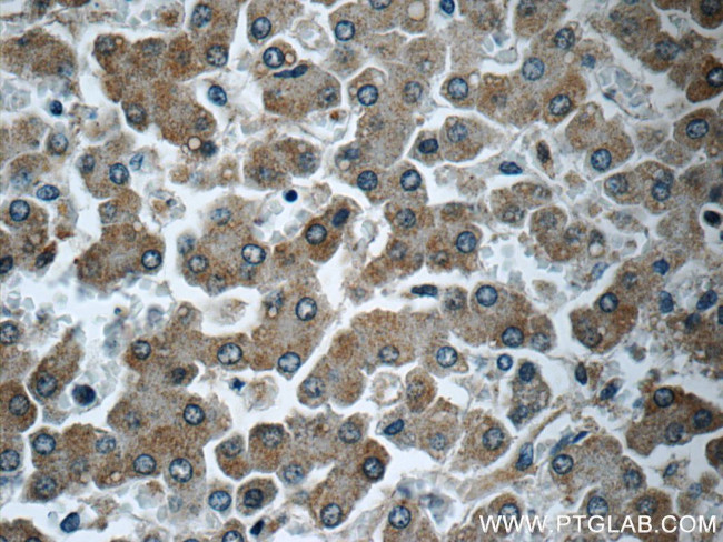 CYP2D6 Antibody in Immunohistochemistry (Paraffin) (IHC (P))