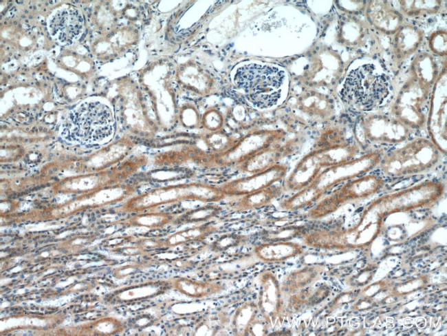 CYP2D6 Antibody in Immunohistochemistry (Paraffin) (IHC (P))