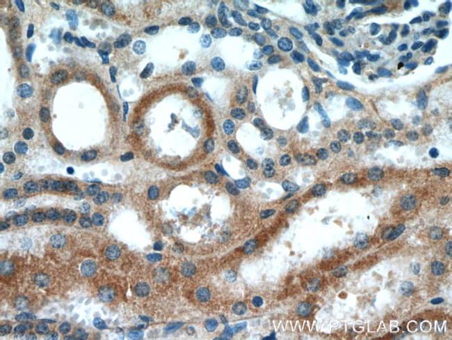 CYP2D6 Antibody in Immunohistochemistry (Paraffin) (IHC (P))