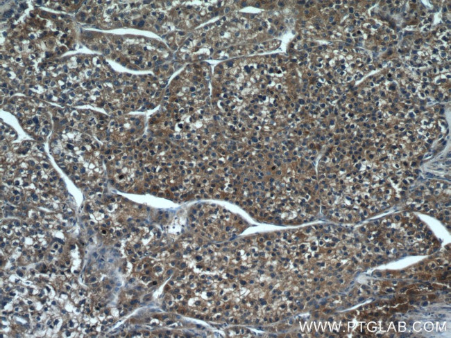 CYP2D6 Antibody in Immunohistochemistry (Paraffin) (IHC (P))