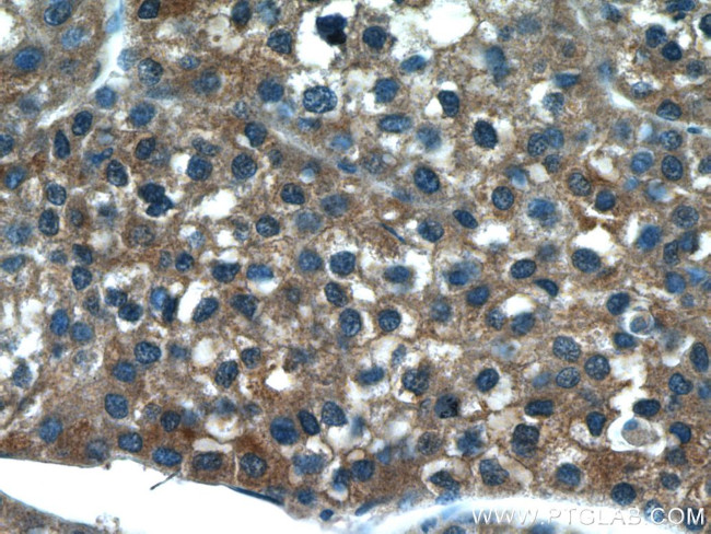 CYP2D6 Antibody in Immunohistochemistry (Paraffin) (IHC (P))