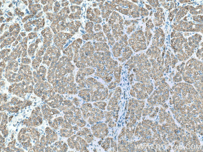 CYP2D6 Antibody in Immunohistochemistry (Paraffin) (IHC (P))