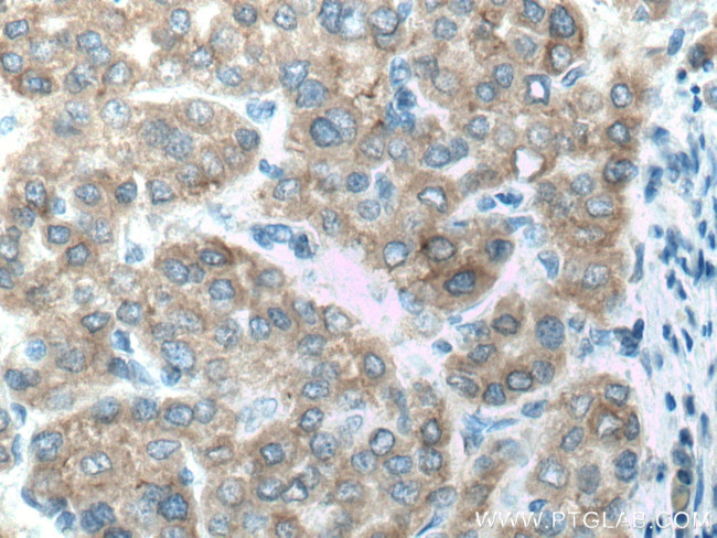 CYP2D6 Antibody in Immunohistochemistry (Paraffin) (IHC (P))