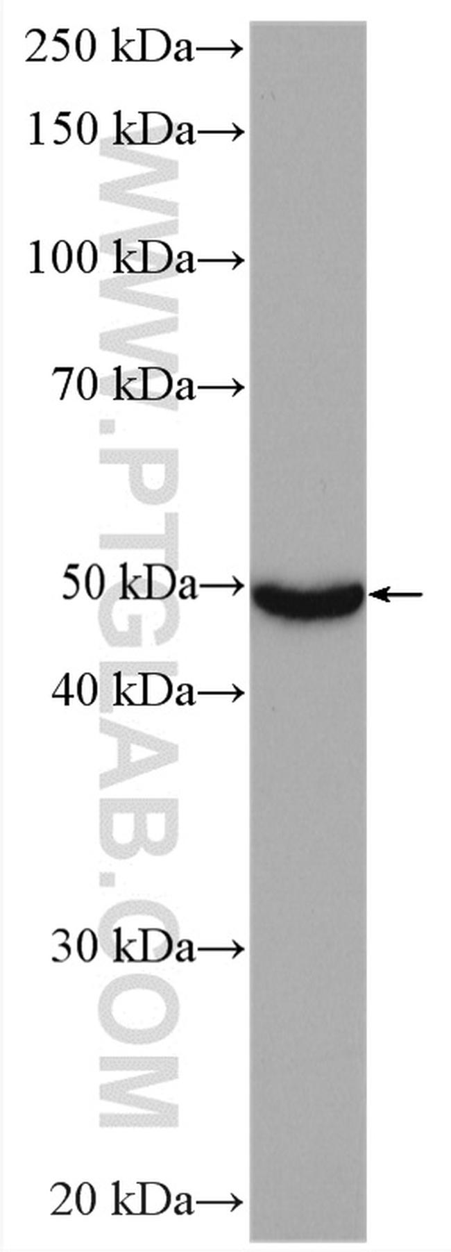 CYP2D6 Antibody in Western Blot (WB)