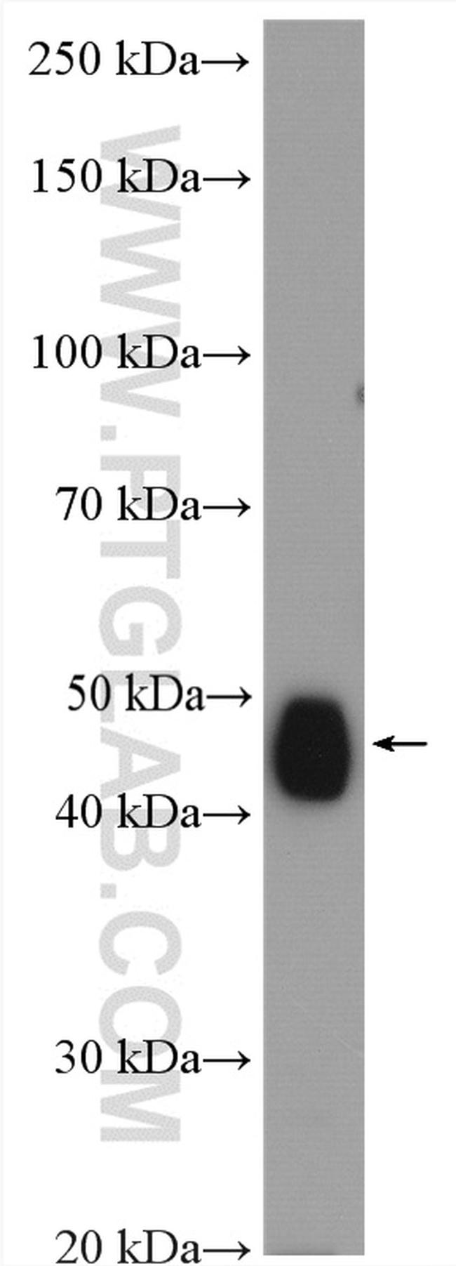 CYP2D6 Antibody in Western Blot (WB)