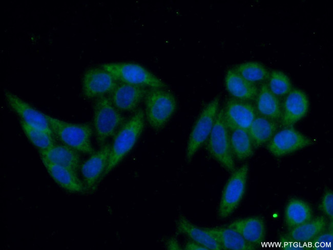 STS Antibody in Immunocytochemistry (ICC/IF)