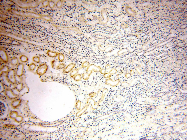 STS Antibody in Immunohistochemistry (Paraffin) (IHC (P))