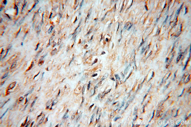 STS Antibody in Immunohistochemistry (Paraffin) (IHC (P))