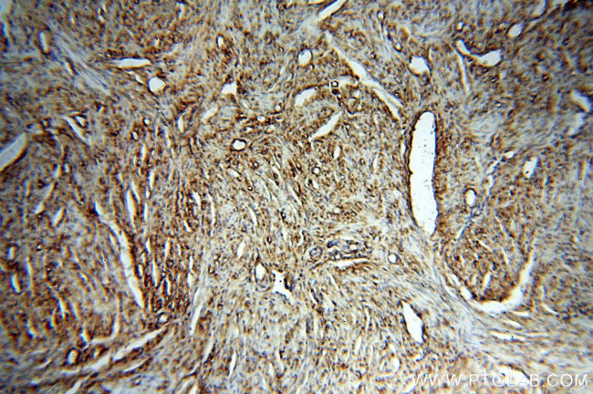 STS Antibody in Immunohistochemistry (Paraffin) (IHC (P))