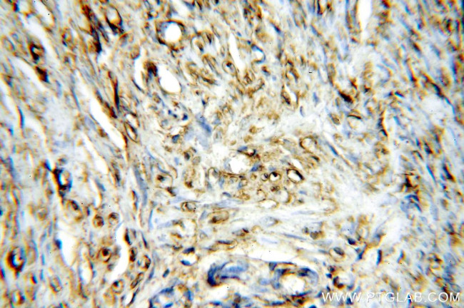 STS Antibody in Immunohistochemistry (Paraffin) (IHC (P))