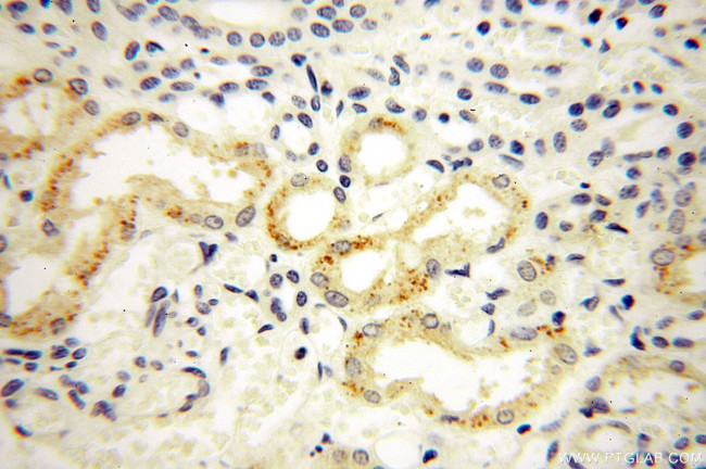 STS Antibody in Immunohistochemistry (Paraffin) (IHC (P))