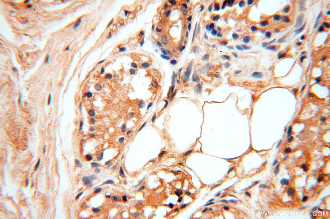 STS Antibody in Immunohistochemistry (Paraffin) (IHC (P))