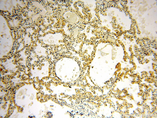 STS Antibody in Immunohistochemistry (Paraffin) (IHC (P))