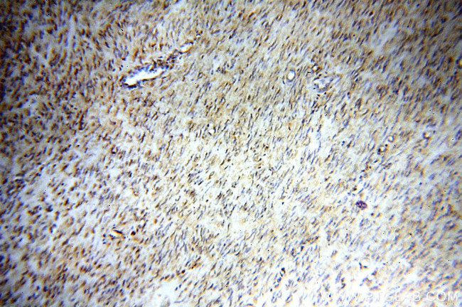 STS Antibody in Immunohistochemistry (Paraffin) (IHC (P))