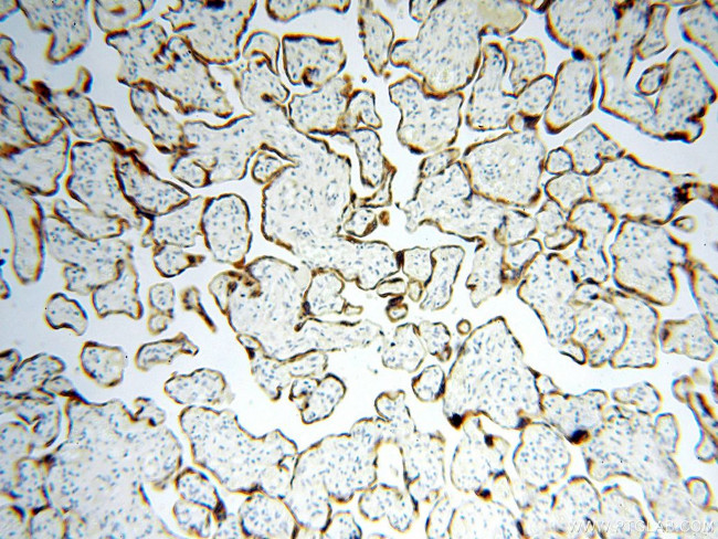 STS Antibody in Immunohistochemistry (Paraffin) (IHC (P))