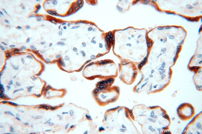 STS Antibody in Immunohistochemistry (Paraffin) (IHC (P))