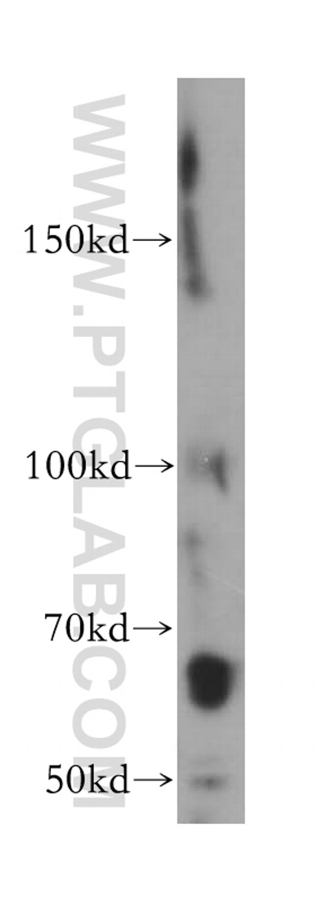 STS Antibody in Western Blot (WB)