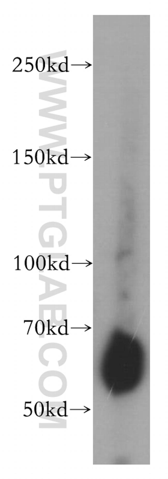 STS Antibody in Western Blot (WB)