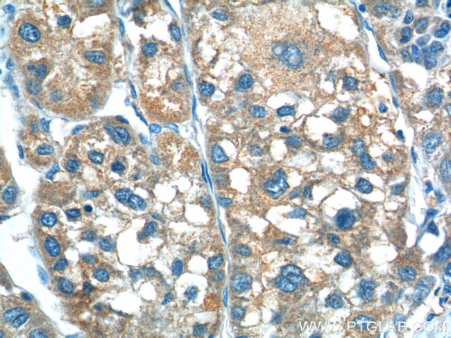 TP53INP1 Antibody in Immunohistochemistry (Paraffin) (IHC (P))