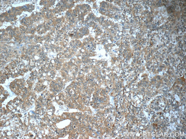 TP53INP1 Antibody in Immunohistochemistry (Paraffin) (IHC (P))