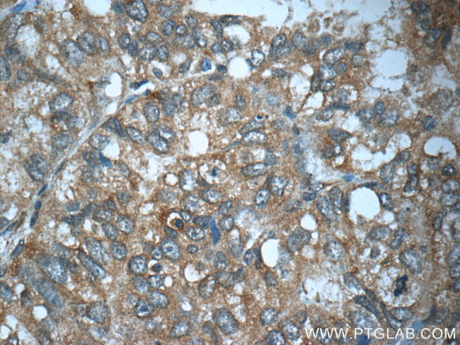 TP53INP1 Antibody in Immunohistochemistry (Paraffin) (IHC (P))