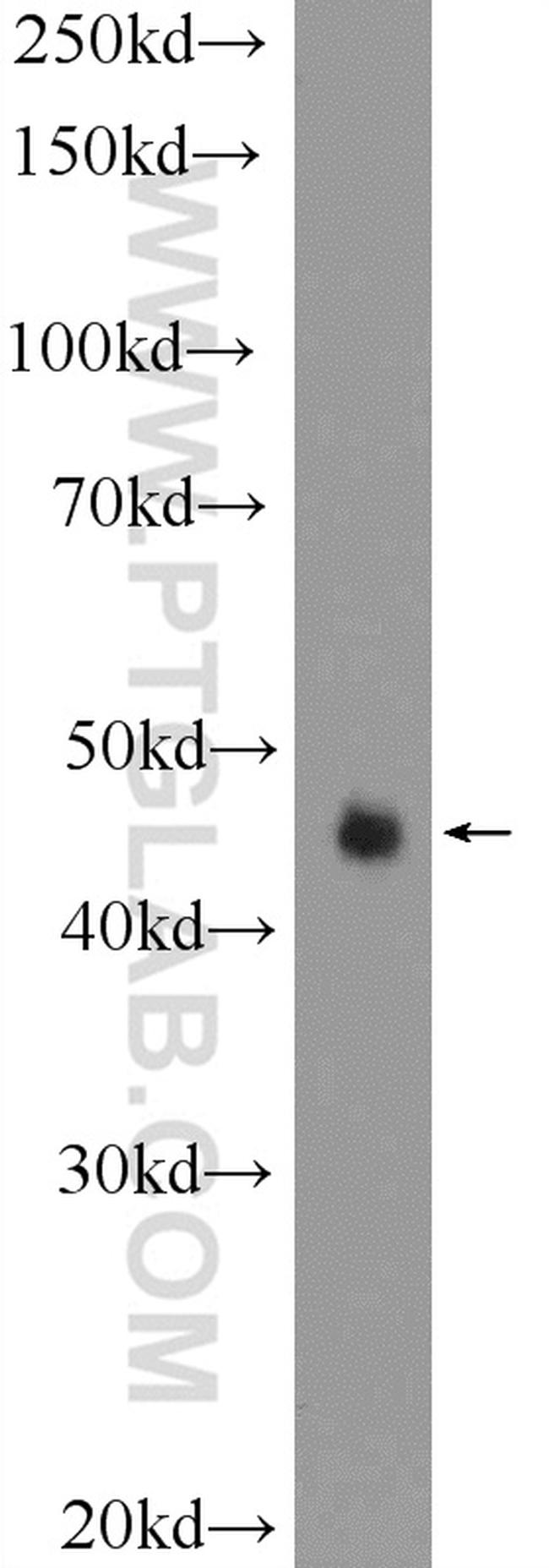 TP53INP1 Antibody in Western Blot (WB)