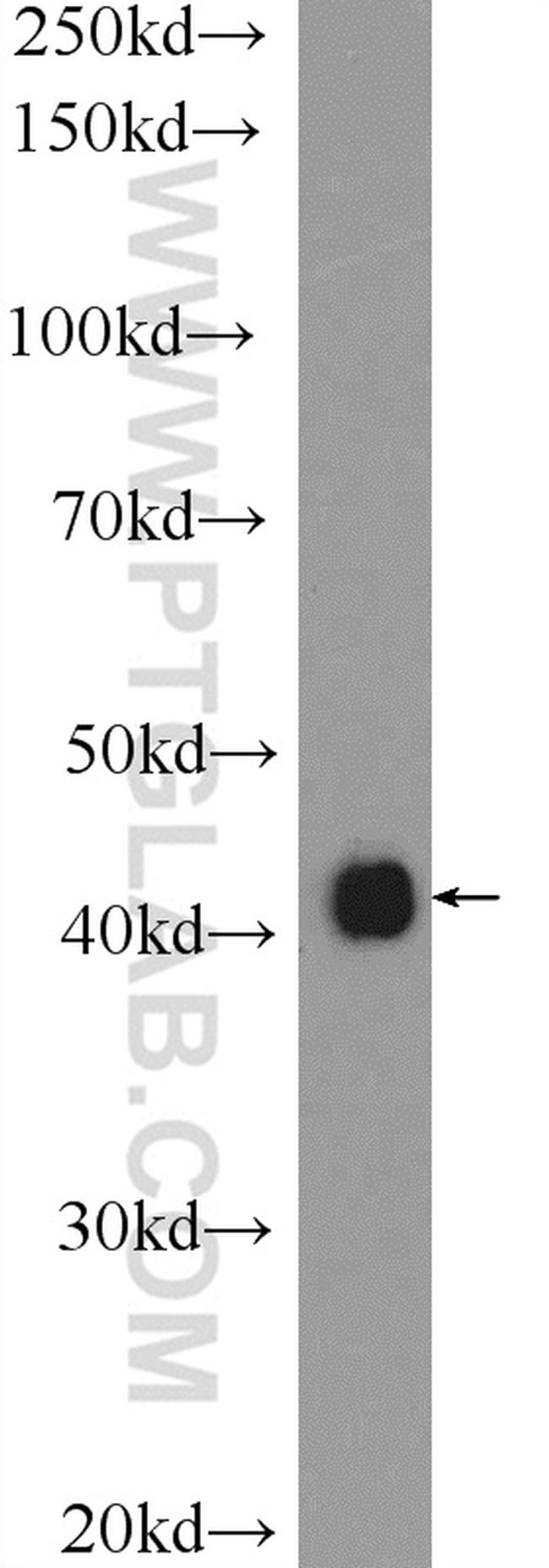 TP53INP1 Antibody in Western Blot (WB)