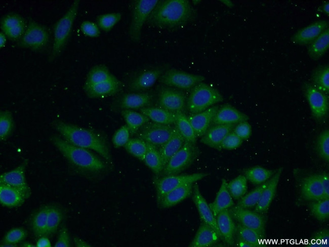 TP53INP1 Antibody in Immunocytochemistry (ICC/IF)