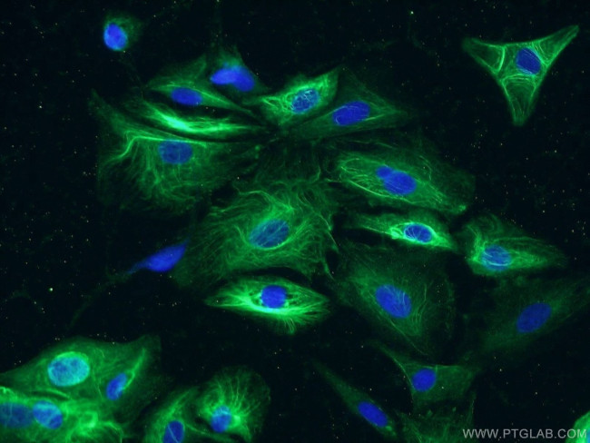 MMP3 Antibody in Immunocytochemistry (ICC/IF)