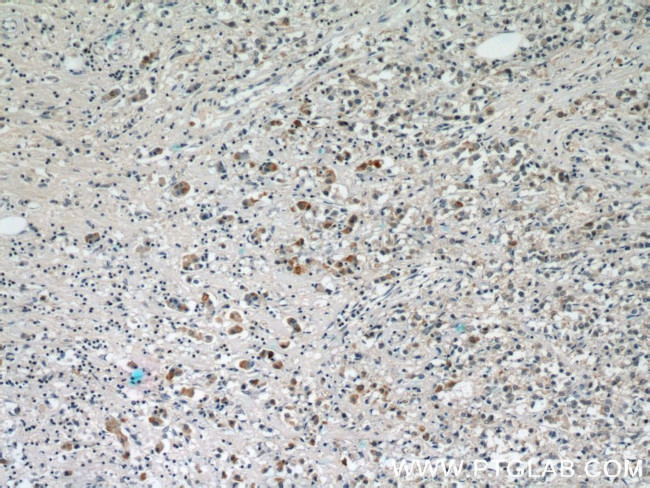 MMP3 Antibody in Immunohistochemistry (Paraffin) (IHC (P))