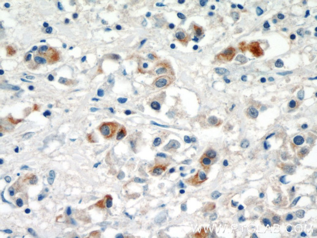 MMP3 Antibody in Immunohistochemistry (Paraffin) (IHC (P))