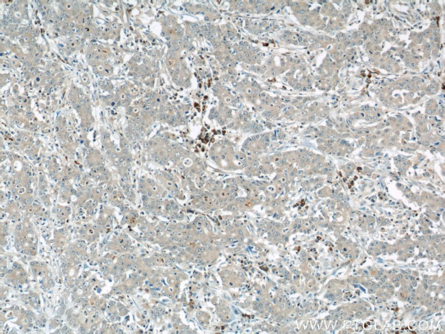 MMP3 Antibody in Immunohistochemistry (Paraffin) (IHC (P))