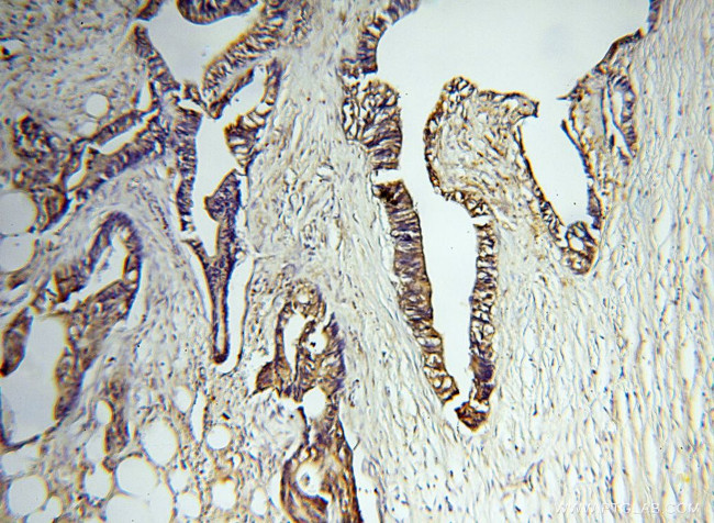 MMP3 Antibody in Immunohistochemistry (Paraffin) (IHC (P))