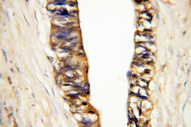 MMP3 Antibody in Immunohistochemistry (Paraffin) (IHC (P))