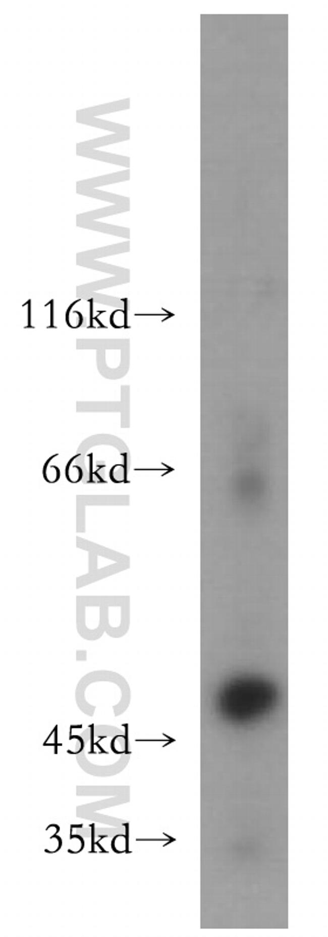 MMP3 Antibody in Western Blot (WB)