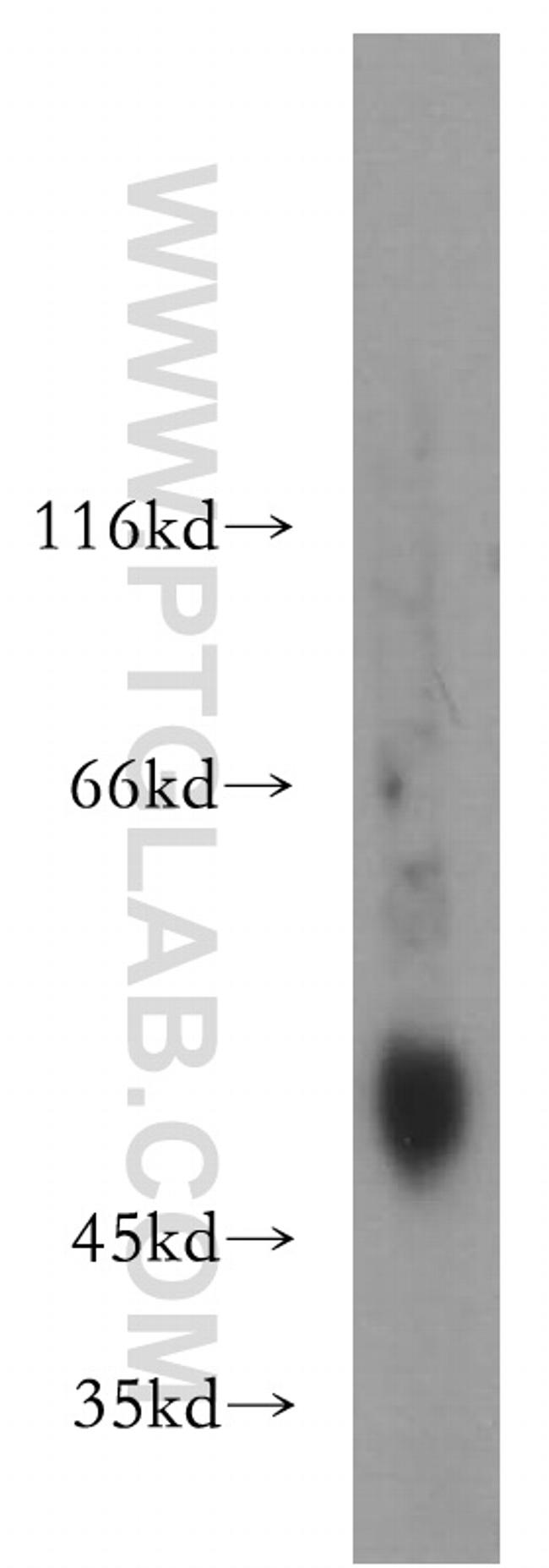 MMP3 Antibody in Western Blot (WB)