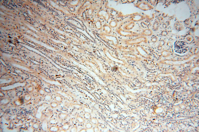 MMP8 Antibody in Immunohistochemistry (Paraffin) (IHC (P))