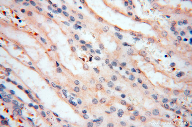 MMP8 Antibody in Immunohistochemistry (Paraffin) (IHC (P))