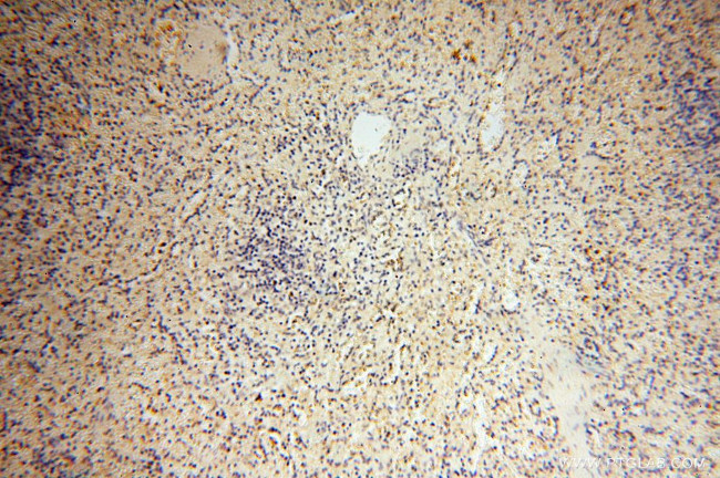 MMP8 Antibody in Immunohistochemistry (Paraffin) (IHC (P))