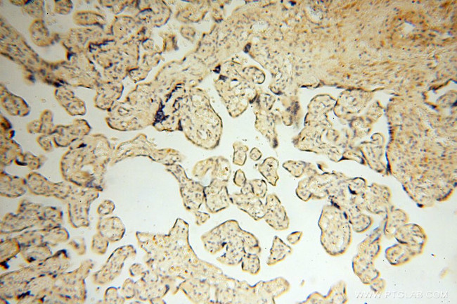 MMP8 Antibody in Immunohistochemistry (Paraffin) (IHC (P))