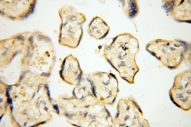 MMP8 Antibody in Immunohistochemistry (Paraffin) (IHC (P))