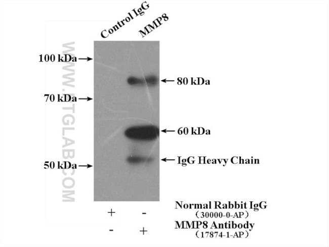 MMP8 Antibody in Immunoprecipitation (IP)