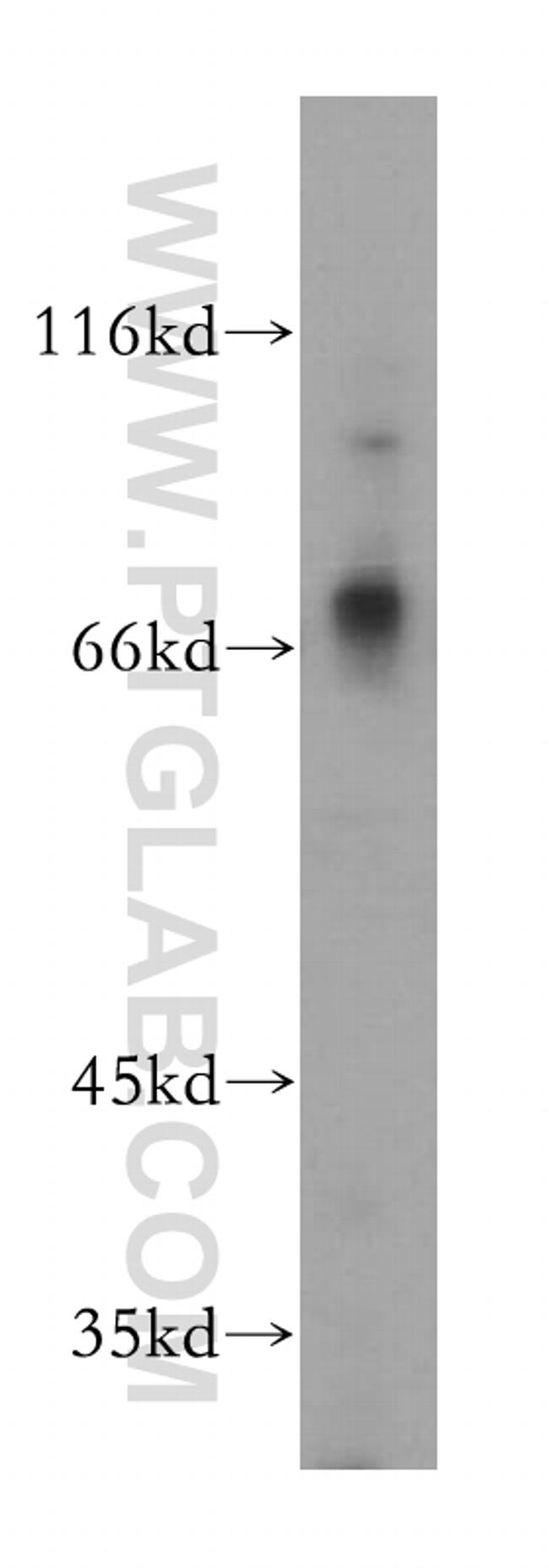 MMP8 Antibody in Western Blot (WB)