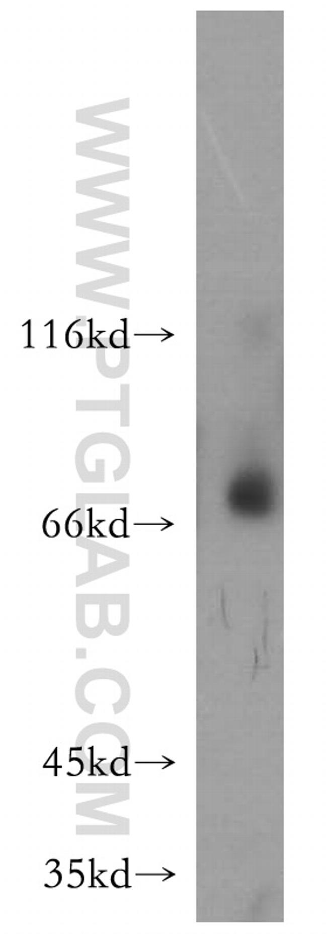 MMP8 Antibody in Western Blot (WB)