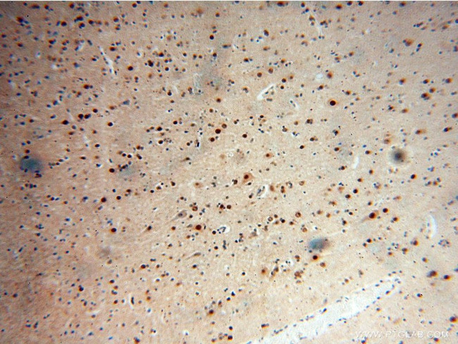 RANBP3L Antibody in Immunohistochemistry (Paraffin) (IHC (P))