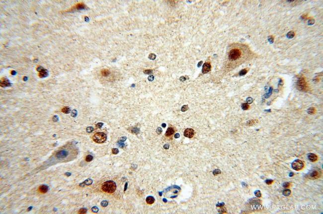 RANBP3L Antibody in Immunohistochemistry (Paraffin) (IHC (P))