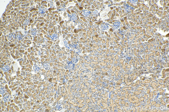 RANBP3L Antibody in Immunohistochemistry (Paraffin) (IHC (P))